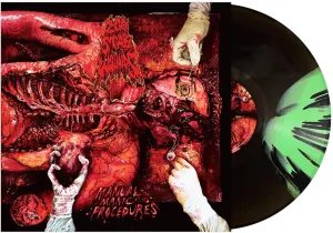 Manual Manic Procedures